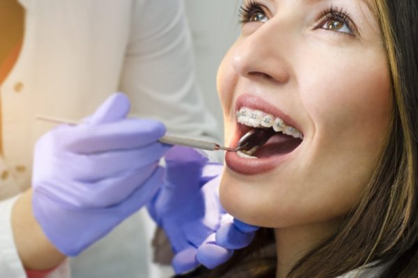 Ортодонтическая стоматология | клиники Семашко