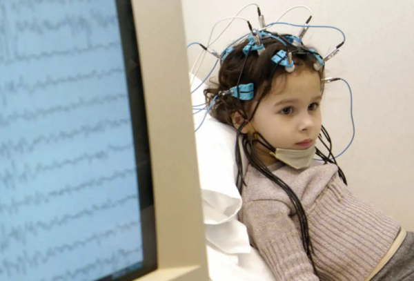 Эпилептолог детский консультация | клиники Семашко